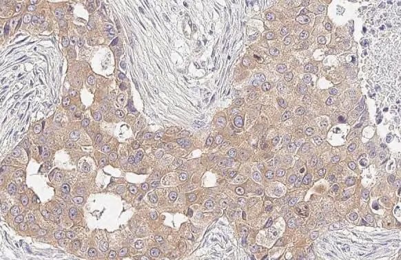 RIPK1/RIP1 Antibody (HL2250) - Azide and BSA Free