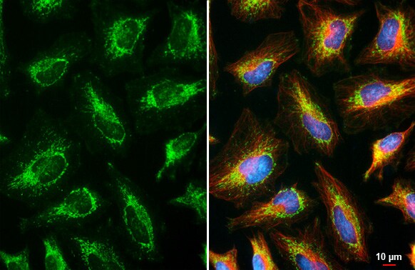 RNase L Antibody (HL2340) - Azide and BSA Free