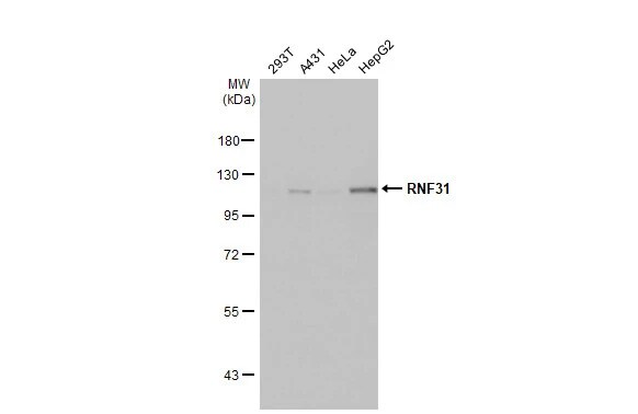 HOIP/RNF31 Antibody (HL2295) - Azide and BSA Free