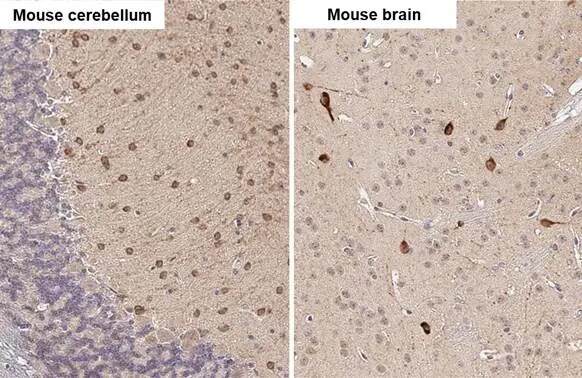 HOIP/RNF31 Antibody (HL2295) - Azide and BSA Free