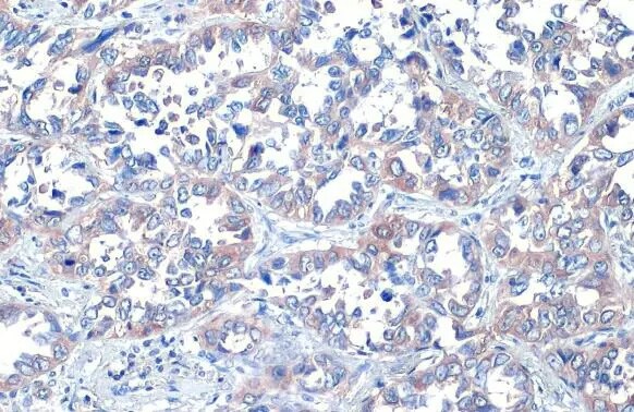 ROCK1/2 Antibody (HL1632) - Azide and BSA Free