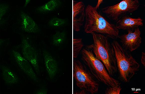ROCK1/2 Antibody (HL1632) - Azide and BSA Free