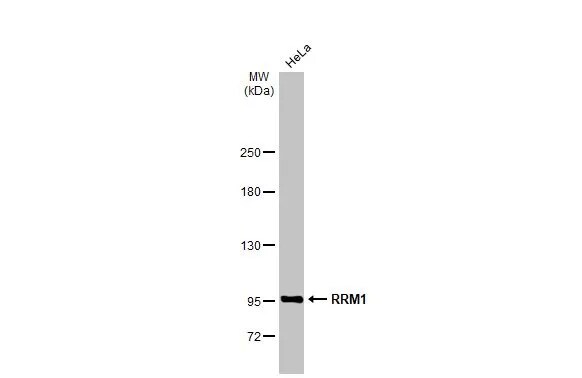 RRM1 Antibody (HL1231) - Azide and BSA Free