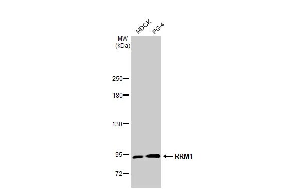 RRM1 Antibody (HL1231) - Azide and BSA Free