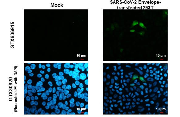 SARS-CoV-2 Envelope Antibody (HL1443) - Azide and BSA Free