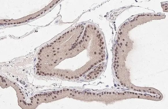 MKK4/MEK4 Antibody (HL1839) - Azide and BSA Free