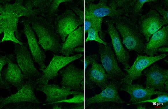 MKK4/MEK4 Antibody (HL1888) - Azide and BSA Free