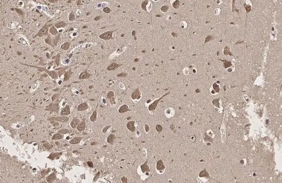 SERCA2 ATPase Antibody (HL2352) - Azide and BSA Free