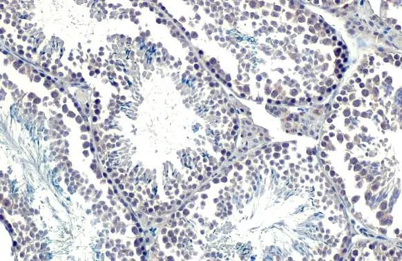 SETDB1 Antibody (HL1645) - Azide and BSA Free