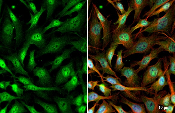 SETDB1 Antibody (HL1645) - Azide and BSA Free