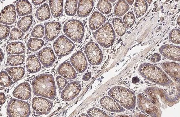 SIGIRR Antibody (HL2008) - Azide and BSA Free
