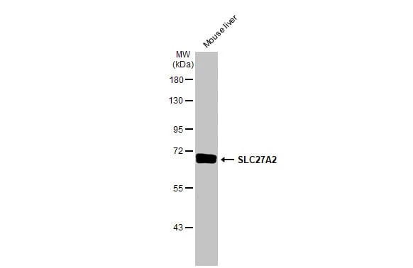 FATP2/SLC27A2 Antibody (HL2232) - Azide and BSA Free