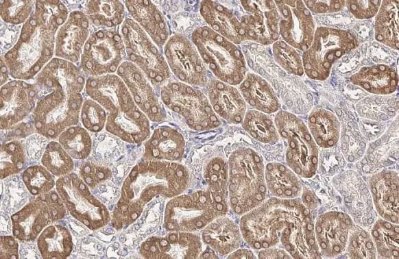 FATP2/SLC27A2 Antibody (HL2232) - Azide and BSA Free