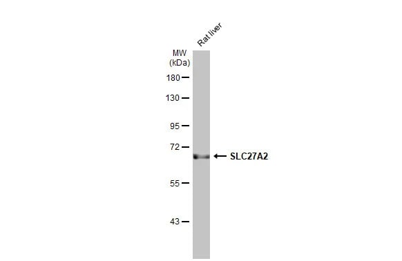 FATP2/SLC27A2 Antibody (HL2232) - Azide and BSA Free