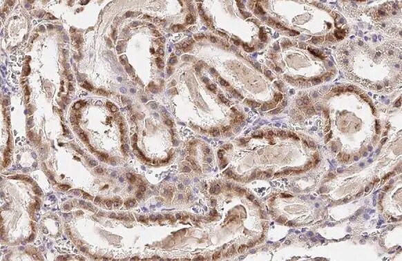 ST6 Gal Sialyltransferase 1/ST6GAL1/CD75 Antibody (HL2318) - Azide and BSA Free
