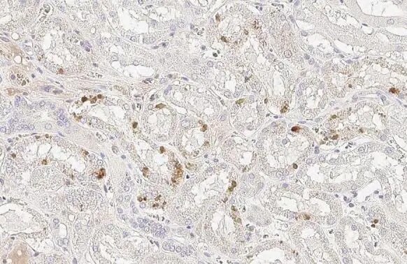 StAR Antibody (HL1360) - Azide and BSA Free