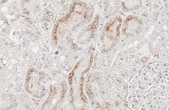 StAR Antibody (HL1360) - Azide and BSA Free