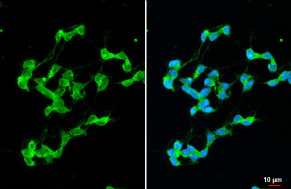 Stargazin Antibody (HL2268) - Azide and BSA Free