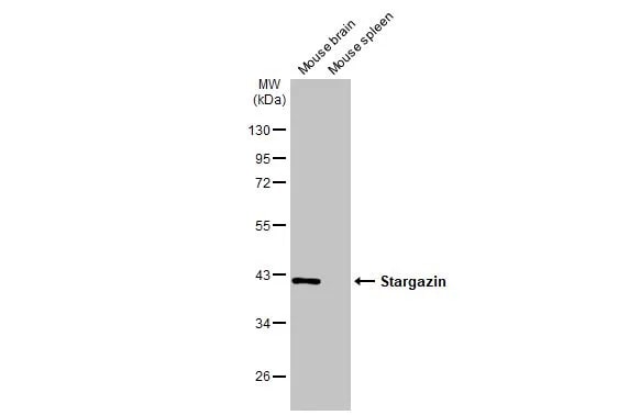 Stargazin Antibody (HL2268) - Azide and BSA Free