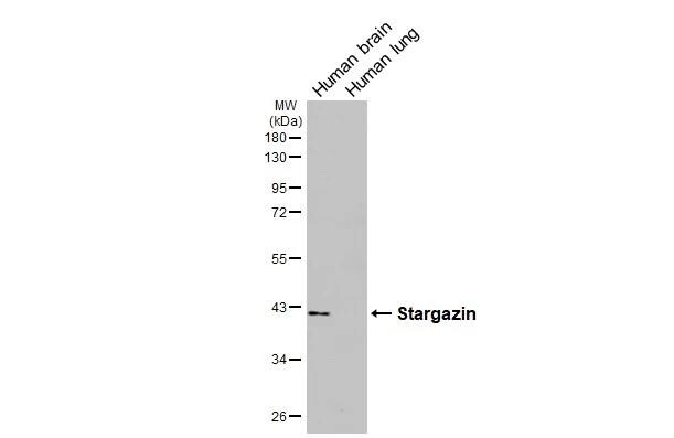 Stargazin Antibody (HL2268) - Azide and BSA Free