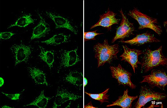 SUCLG1 Antibody (HL2387) - Azide and BSA Free