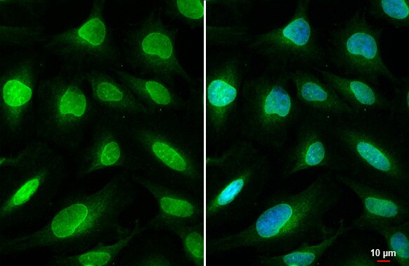 SUN1 Antibody (HL1946) - Azide and BSA Free