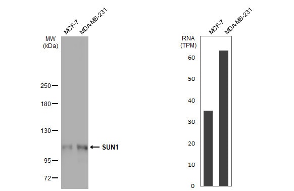 SUN1 Antibody (HL1947) - Azide and BSA Free