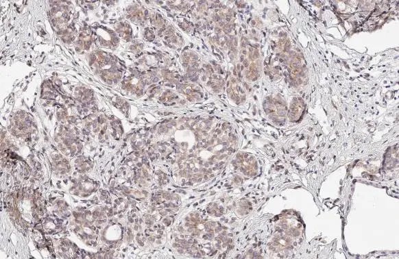 SUN1 Antibody (HL1947) - Azide and BSA Free
