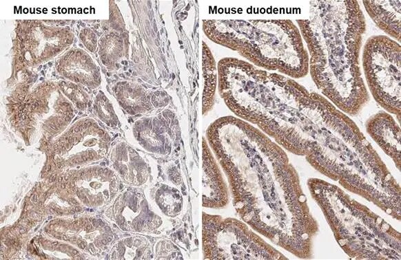 TBC1D5 Antibody (HL2054) - Azide and BSA Free