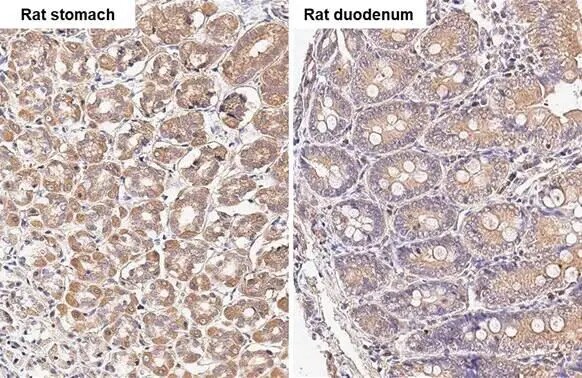 TBC1D5 Antibody (HL2390) - Azide and BSA Free