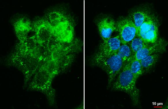 TBC1D5 Antibody (HL2390) - Azide and BSA Free