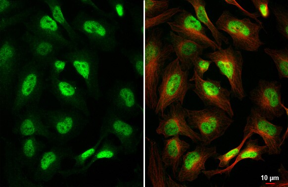 TCF-3/E2A Antibody (HL1954) - Azide and BSA Free