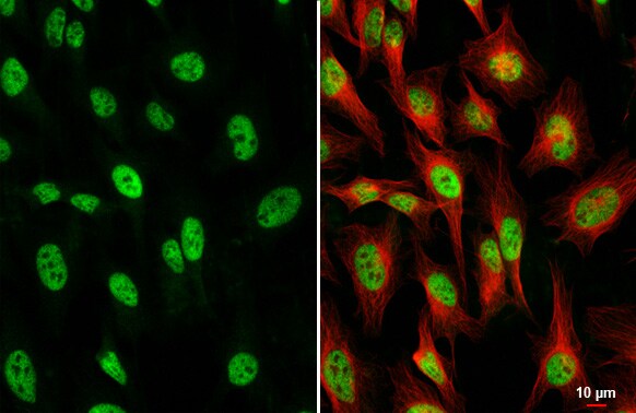 TCF-3/E2A Antibody (HL1955) - Azide and BSA Free