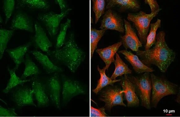 Thymidylate Synthase Antibody (HL1236) - Azide and BSA Free