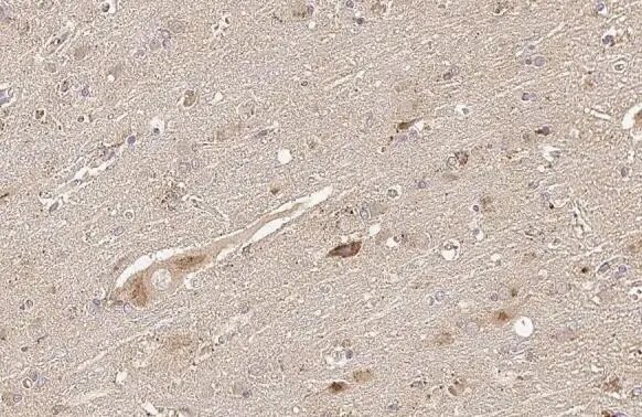Thymidylate Synthase Antibody (HL1236) - Azide and BSA Free