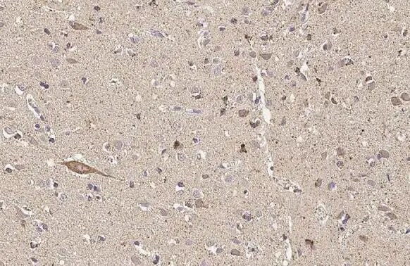 Thymidylate Synthase Antibody (HL1236) - Azide and BSA Free