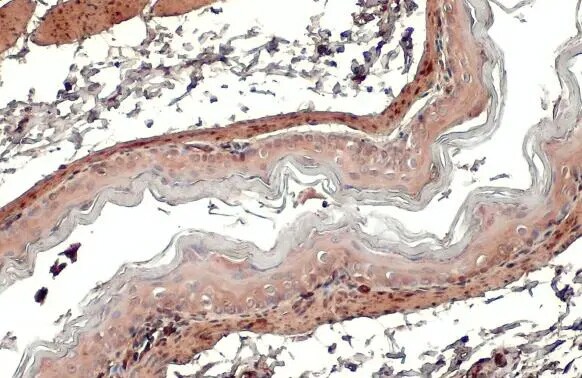 Transgelin/TAGLN/SM22 alpha Antibody (HL1270) - Azide and BSA Free