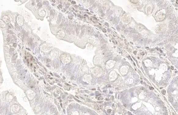 Transgelin/TAGLN/SM22 alpha Antibody (HL1270) - Azide and BSA Free