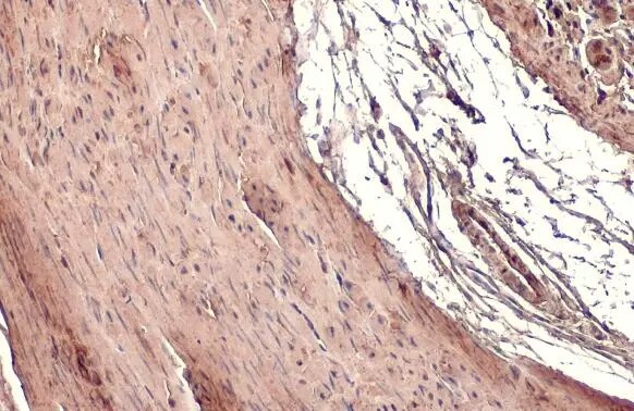 Transgelin/TAGLN/SM22 alpha Antibody (HL1270) - Azide and BSA Free
