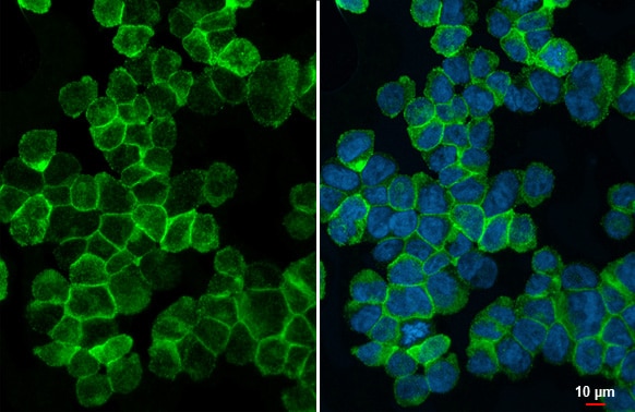 TREM2 Antibody (HL1738) - Azide and BSA Free