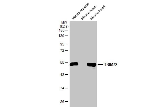 TRIM72 Antibody (HL1853) - Azide and BSA Free