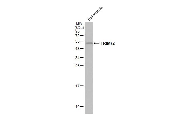 TRIM72 Antibody (HL1855) - Azide and BSA Free