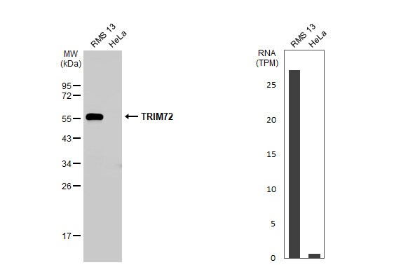 TRIM72 Antibody (HL1855) - Azide and BSA Free