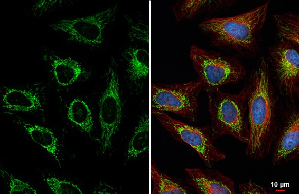 TUFM Antibody (HL2193) - Azide and BSA Free