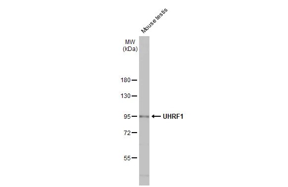 UHRF1 Antibody (HL2287) - Azide and BSA Free