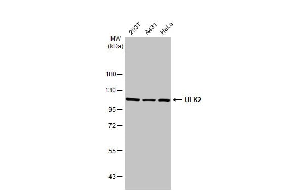 ULK2 Antibody (HL2206) - Azide and BSA Free