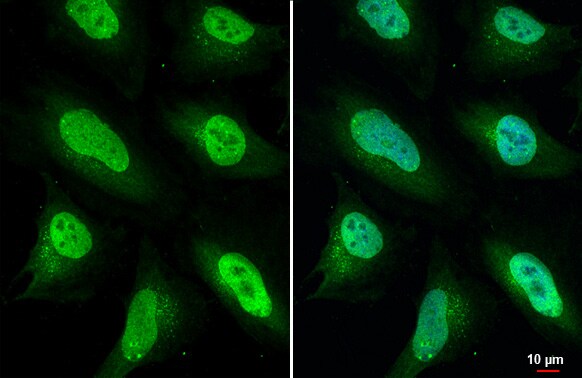 ULK2 Antibody (HL2206) - Azide and BSA Free
