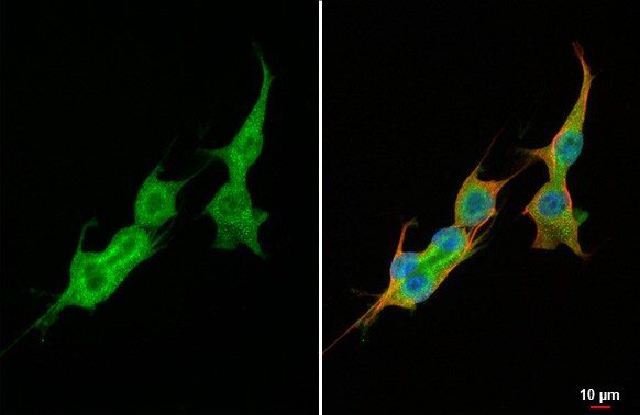 VEGF-C Antibody (HL2289) - Azide and BSA Free