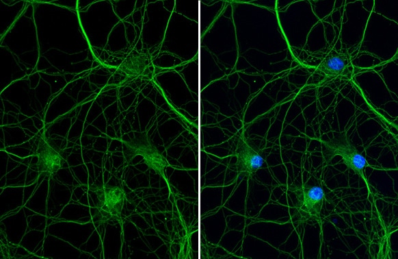 VRL1 Antibody (HL1543) - Azide and BSA Free
