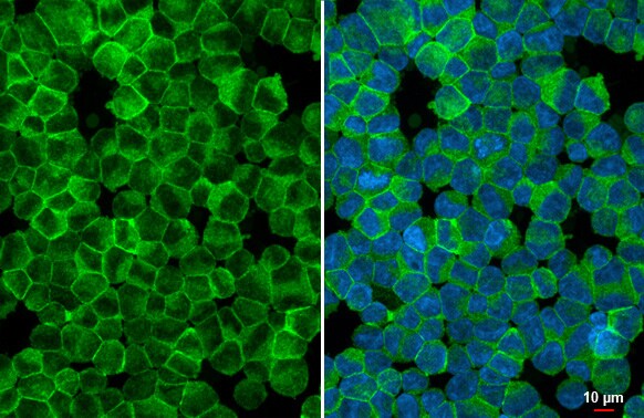 VRL1 Antibody (HL1543) - Azide and BSA Free